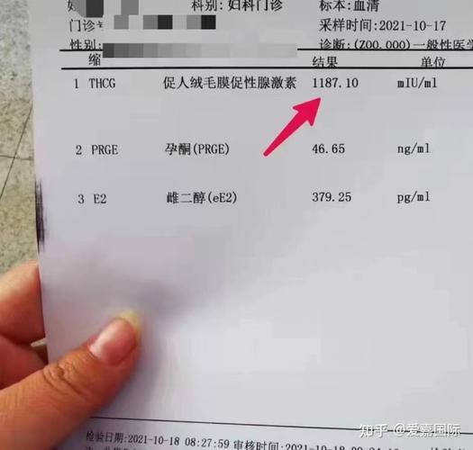 代生男孩包成功多少费用-代生男孩包成功费用大揭秘