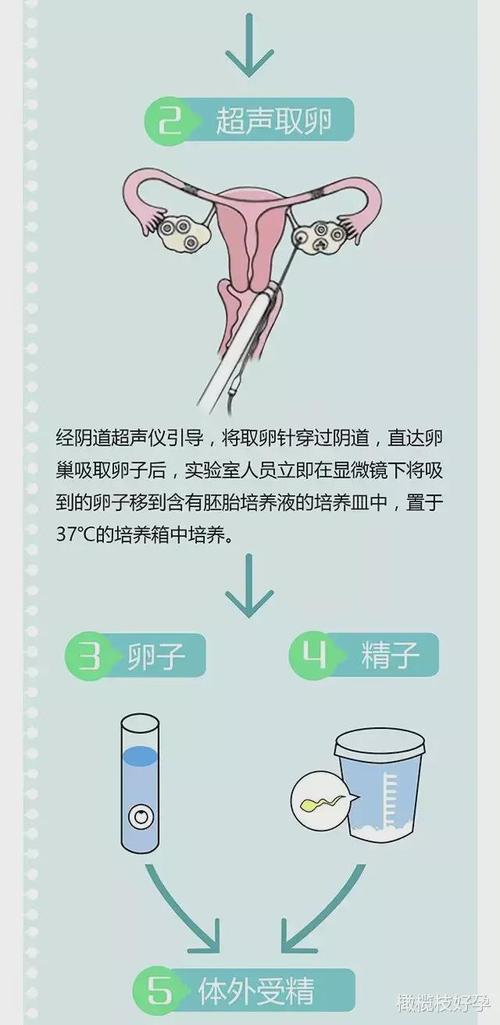 最大年纪精子试管代怀-最大年纪精子试管代怀:突破年龄限制的生育奇迹